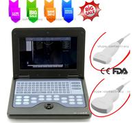 Portable Laptop Machine Digital Ultrasound Scanner 3.5M Convex Probe,7.5M linear