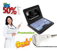 Portable laptop machine Digital Ultrasound Scanner 3.5Mh Convex probe, CE proved