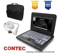 Portable Laptop Machine Digital Ultrasound Scanner 7.5MLinear Probe Rechargeable
