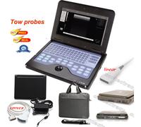 Portable laptop machine Digital Ultrasound scanner,Convex probe, linear