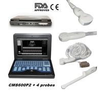 Portable laptop ultrasound scanner 4 probes convex/linear/transvaginal optional