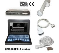 Portable laptop ultrasound scanner 4 probes convex/linear/transvaginal optional
