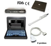 Portable laptop ultrasound scanner 4 probes convex/linear/transvaginal optional