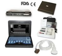 Portable laptop ultrasound scanner 4 probes convex/linear/transvaginal optional