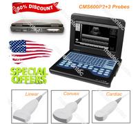Portable Ultrasound Scanner Laptop Machine 3 Probes Convex/Linear/Cardiac