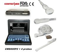 Portable Ultrasound Scanner Laptop Machine+4 Probes Convex Linear Cardia Vaginal