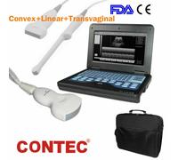 Portable Ultrasound Scanner Laptop Machine CMS600P2 For Human Option 4 Probe