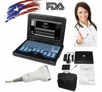 Portable Ultrasound Scanner Laptop Machine CMS600P2 For Human Option 4 Probe