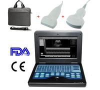 Portable Ultrasound Scanner Laptop Machine Convex+Linear 2 Probes Human CMS600P2