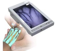 Portable Vein Finder for IV and Veinpuncture, Illumination Detector Visualization for Various Skin Types, Paramedics and Hospitals
