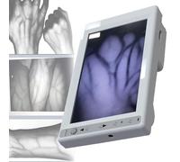 Portable Vein Locator, Handheld Vascular Display Device for Easy Subcutaneous Vein Detection in Elderly