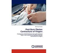 Post Burn Flexion Contracture of Fingers: Comparison of full thickness skin graft and local flaps in the treatment of postburn flexion contractures of fingers