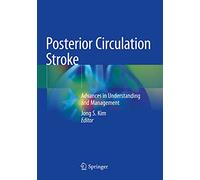 Posterior Circulation Stroke: Advances in Understanding and Management