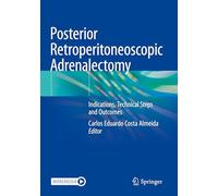 Posterior Retroperitoneoscopic Adrenalectomy: Indications, Technical Steps and Outcomes