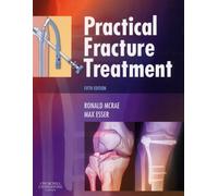 Practical Fracture Treatment