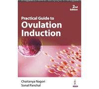 Practical Guide to Ovulation Induction