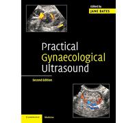 Practical Gynaecological Ultrasound
