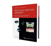 Practical Implant Dentistry
