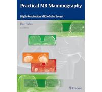 Practical MR Mammography: High-Resolution MRI of the Breast – Thieme