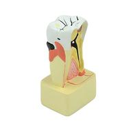 Practical Pathology Teeth Model 4 Analysis for Dentist Teaching Dentistry Clinic Child Teeth Model Studying Tooth Pathology Module for Medical Science