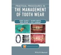 Practical Procedures in the Management of Tooth Wear