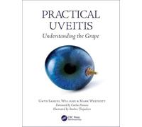 Practical Uveitis: Understanding the Grape
