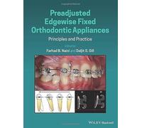 Preadjusted Edgewise Fixed Orthodontic Appliances: Principles and Practice