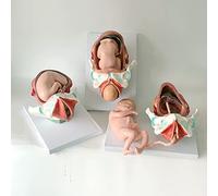 Pregnant Embryo Female Term Fetus Delivery Process Birth Fetus Baby Three-Piece Set Obstetrics And Gynecology Teaching D