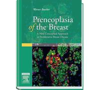 Preneoplasia of the Breast: A New Conceptual Approach to Proliferative Breast Disease