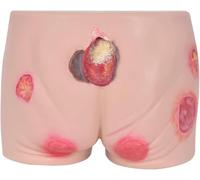 Pressure Sore Nursing Model, Advanced Pressure Bedsores Ulcers Nursing Simulator, Wound Packing Trainer, Pressure Ulcer Models of Different Degrees Elder Butt Model, for Wound Care Educational Tool.