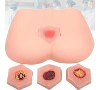 Pressure Sore Simulator Nursing Model, Wearable Decubitus Ulcer Training Model, PVC Bedsores Pressure Sore Model 4 Stages of Bedsores, for Practical Simulation, Nursing Teaching.