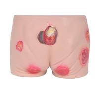 Pressure Ulcer Wound Model, Decubitus Sore Training Simulator with Multiple Simulated Ulcer Wounds for Nursing Practice