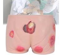 Pressure Ulcers Nursing Model, Silicone Buttock Wound Model, Different Degrees Elder Butt Model for Medical Training, Students Education