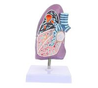 PRETYZOOM Smoking Lung Model Pathological Anatomy Teaching Tool for Respiratory Education Display for Medical Students Teachers Health Professionals for Anatomy Physiology Classes