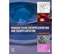 Principles and Practice of Ovarian Tissue Cryopreservation and Transplantation