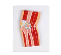 Professional Anatomical Elbow Joint Model with Detailed Muscles Ligaments for Patient Communication Clinical Training Dissection