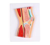 Professional Anatomical Patella Knee Joint Model with Muscles Ligaments for Patient Communication and Clinical Training Dissectible Knee Model