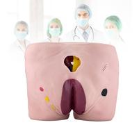Professional Bedsore Care Training Model, Decubitus Ulcer Pressure Sore Simulator with 4 Stages of Wound Display, Realistic Buttocks Nursing Manikin for Medical School, Nursing Student Training
