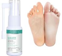 Professional Callus Remover Extra Strength Spray, 2025 New Foot Callus Removal Spray, Foot Peeling Sprays for Remove Dead Skin & Calluses on Feet, Instant Foot Peeling Spray for All Skin Types (1pcs)