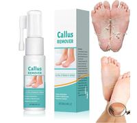 Professional Callus Remover Extra Strength Spray, 2025 New Foot Callus Remover Extra Strength Spray, Foot Peeling Oil, Foot Peeling Oil for All Skin Types Remove Dead Skin and Calluses On Feet (1pc)