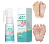 Professional Callus Remover Extra Strength Spray,Foot Callus Removal Spray,Foot Peeling Spray Oil,Foot Callus Remover Extra Strength Spray for All Skin Types (1 Pcs)