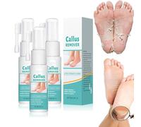 Professional Callus Remover Extra Strength Spray, Foot Callus Remover Extra Strength Spray, Foot Peeling Oil, Foot Peeling Oil for All Skin Types Remove Dead Skin And Calluses On Feet (3Pc)