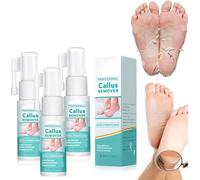 Professional Callus Remover Extra Strength Spray, Foot Callus Remover Extra Strength Spray, for Remove Dead Skin and Calluses on Feet, Instant Foot Peeling Spray Oil for All Skin Types (3pcs)