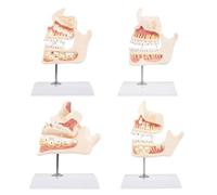 Professional Dentals Teaching Teeth Demonstration Model Showing Teeth Development Stage Ideal for Schools and Clinics Odontological Development Model