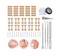 Professional Ingrown Toenail Set with Breathable Ingrown Toenail Strips, Curved Toenails Corrector Patch, Professional Pedicure Tools Kit for Ingrown & Curved Toenails,Ingrown Toenail Removal Kit