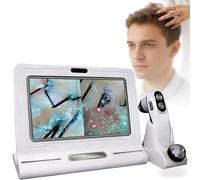Professional Scalp Analyzer with 11" HD Display Portable Handle Probe Hair Skin Scope for Head Spa Consultations