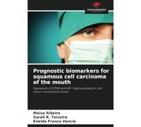 Prognostic biomarkers for squamous cell carcinoma of the mouth: Expression of CD90 and HIF-1 alpha proteins in the tumor microenvironment