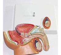 Prostate Model Male Prostate Reproductive System Anatomical Anatomy Science Classroom Decoration Teaching Model Models Educational Materials