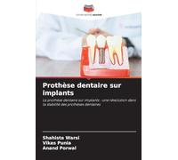 Prothèse dentaire sur implants: La prothèse dentaire sur implants : une révolution dans la stabilité des prothèses dentaires