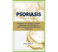 PSORIASIS: Discovery of Psoriasis: Causes, Diagnosis, and Methods for Patient-Centered Dermatological Treatment